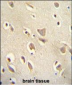 MCHR1 Antibody (C-term)