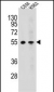 MCHR1 Antibody (C-term)
