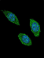 CSF2 Antibody (Center)