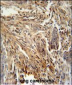 CSF2 Antibody (Center)