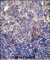 BCL10 Antibody (N-term)
