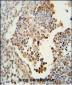 CADM1 Antibody (N-term)