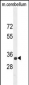 CADM1 Antibody (N-term)