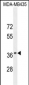 CADM1 Antibody (N-term)