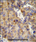 COL18A1 Antibody (Center)
