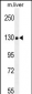 COL18A1 Antibody (Center)