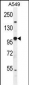 EPAS1 Antibody (N-term)