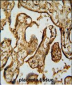 MPP1 Antibody (Center)