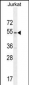 MPP1 Antibody (Center)