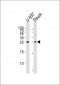 CD37 Antibody (Center)