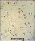 GRIA4 Antibody (Center)