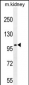 GRIA4 Antibody (Center)