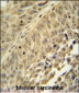 HNRNPC Antibody (C-term)