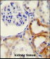 HYAL2 Antibody (C-term)