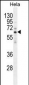 HYAL2 Antibody (C-term)