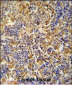 IBTK Antibody (Center)