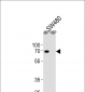 ETV5 Antibody (N-term)