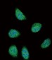 SERPINA6 Antibody (Center)