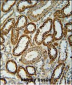 NDUFC2 Antibody (C-term)