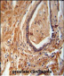 NDUFAF1 Antibody (C-term)