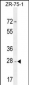 NDUFAF1 Antibody (C-term)