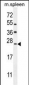 LMO4 Antibody (Center)