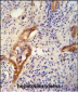 CLPX Antibody (C-term)