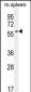 CE037 Antibody  (C-term)