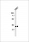 P5F1B Antibody (C-term)