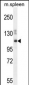 SYNE3 Antibody  (C-term)