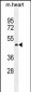 PTCD2 Antibody (Center)