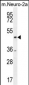 CTBP1 Antibody (C-term)