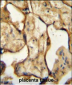 CSH1 Antibody (C-term)