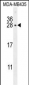 CSH1 Antibody (C-term)