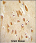 MAPK8 Antibody (T183/Y185)