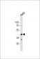 MAPK8 Antibody (T183/Y185)