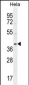 CCNG1 Antibody (N-term)