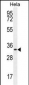 CCNH Antibody (C-term)