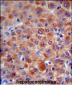 CFH Antibody (Center)