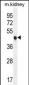 CDKN1C Antibody (N-term)