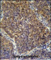 CD2BP2 Antibody (N-term)