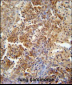 ERCC8 Antibody (Center)