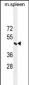 ERCC8 Antibody (Center)