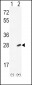 IL18 Antibody (Center)