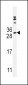 IL18 Antibody (Center)