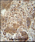 TAGAP Antibody (Center)