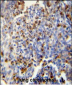 FOSL2 Antibody (Center)