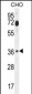 FOSL2 Antibody (Center)