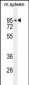 DTL Antibody (Center)