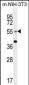 GCNT3 Antibody (C-term)